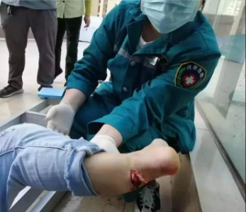 救命！旋转90度的脚让她惊恐无措，还好急诊医生在身边！