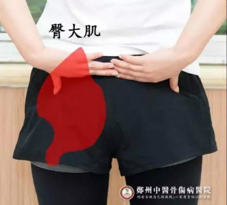 速来！遇到臀大肌疼痛，我们该怎么做？